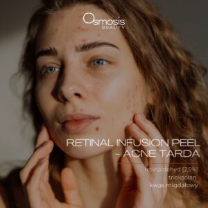 RETINAL INFUSION PEEL- ACNE TARDA